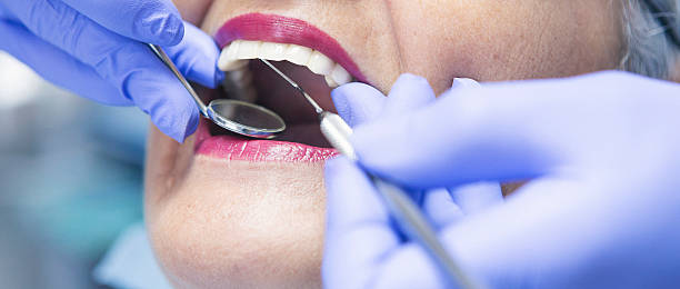 Best Emergency Dentist for Lost Fillings or Crowns in West Fork, AR